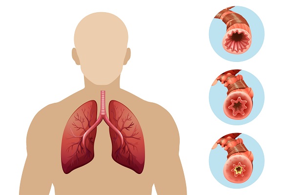 How to Treat Lung Problems with the Help of Ayurveda