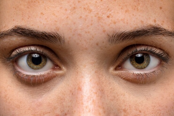 Natural Ways to Reduce Puffy Eyes and Dark Circles
